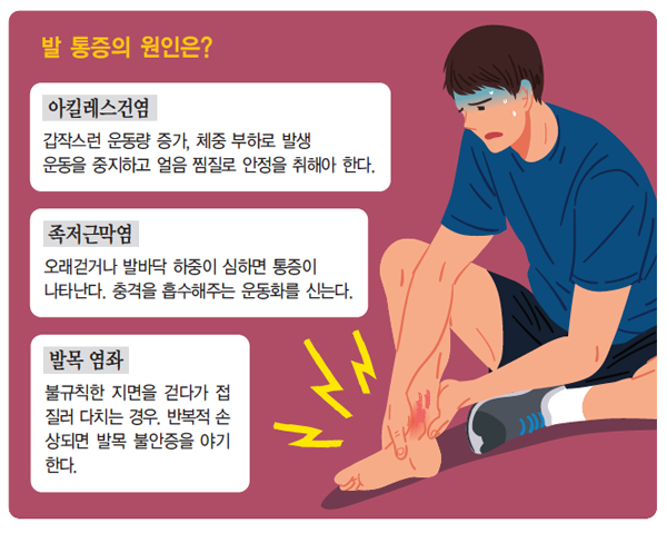 발통증 원인 — 발목염좌 / 아킬레스건염 / 족저근막염