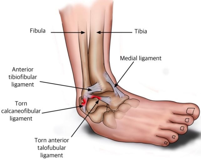 발목 인대 해부학 — Fibula·Tibia 구조