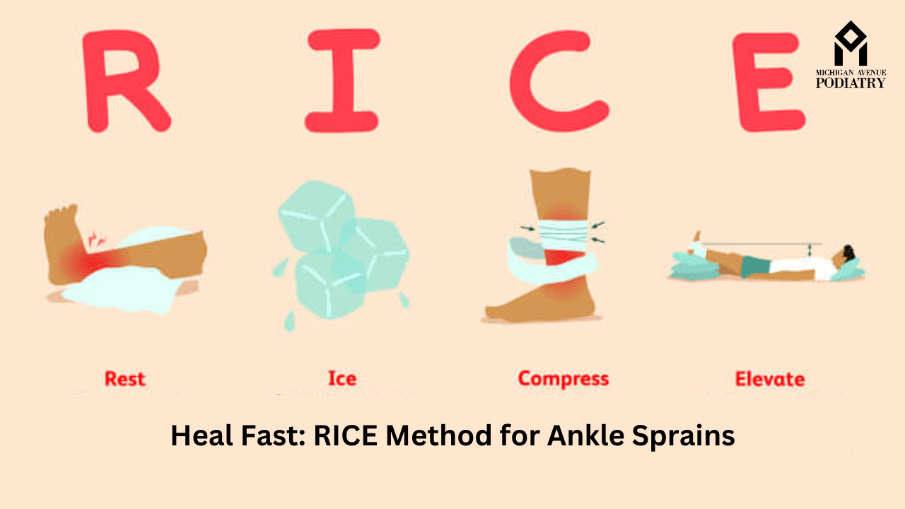 RICE 요법 인포그래픽 — Rest·Ice·Compression·Elevation