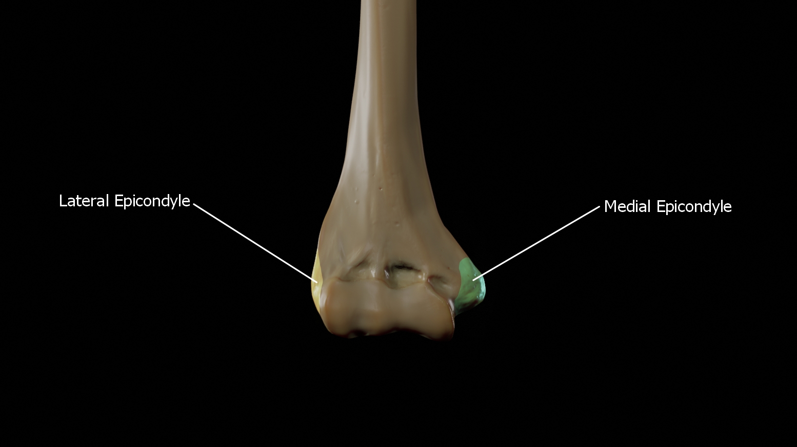 위팔뼈 아래쪽의 내측상과(Medial Epicondyle)와 외측상과(Lateral Epicondyle) 위치를 표시한 해부 이미지